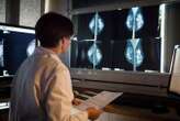 AI helps radiologists spot breast cancer in real-world tests