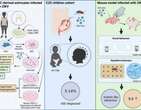 NeuroinflamaÃ§Ã£o gerada pelo vÃ­rus zika aumenta risco de crianÃ§a ter autismo