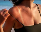 Autobronzeador, pÃ­lulas, Ã³leo... o que pode ou nÃ£o ser usado para manter o bronzeado?
