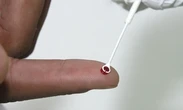 SaÃºde amplia vacinaÃ§Ã£o contra o HPV para usuÃ¡rios entre 15 e 45 anos em prÃ©-exposiÃ§Ã£o