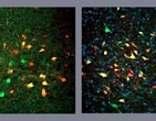 NeurÃ´nios deflagram busca frenÃ©tica por alimentos, mesmos em fome