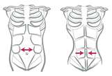 Tecnologia eletromagnÃ©tica trata diÃ¡stase abdominal de forma nÃ£o invasiva