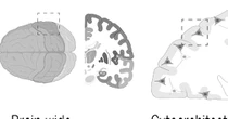 Una nuova finestra sul cervello. La risoluzione è senza precedenti. #imaging