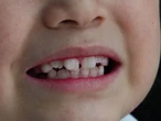 ¡Histórico avance! Científicos logran cultivar dientes humanos en laboratorio
