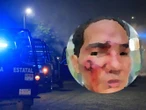 Joven denuncia golpiza por parte de personal de seguridad de un centro nocturno en SLP