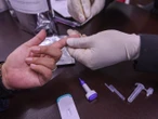 Censida: 80 mil personas en México podrían tener VIH y no lo saben 