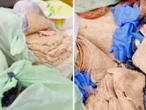 ¡Milanesas de papel higiénico! Cae hombre por vender insólito menú