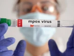 La OMS declara el fin del mpox como urgencia de salud pública internacional