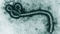 São Paulo investiga caso suspeito de Ebola em homem de 37 anos