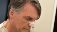 Bolsonaro começa dieta líquida e tem melhora progressiva dos movimentos intestinais