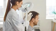 Veja as causas e os tratamentos para a alopecia areata