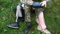 Rússia se orgulha de ser líder em próteses para mutilados após anos de conflito na Ucrânia