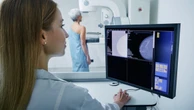 6 dicas para se sentir mais segura na mamografia