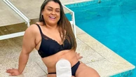 Câncer de intestino, que matou Preta Gil, está em alta em adultos com até 50 anos