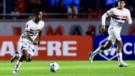Escalação do São Paulo: Zubeldía tem desfalques para enfrentar o Náutico