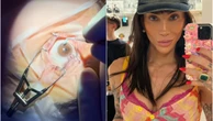 Mudar a cor dos olhos como Maya Massafera é sonho estético ou risco à visão?