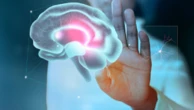 Neurologia em alta definição: os avanços da medicina nuclear no diagnóstico precoce de epilepsia, Alzheimer e Parkinson