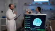 Saiba tudo sobre a pressão intracraniana e os avanços no seu tratamento