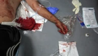 Em meio ao colapso dos bancos de sangue, número de mortos em Gaza chega a 64.900