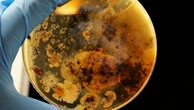Uma em cada seis infecções bacterianas no mundo é resistente a antibióticos, alerta OMS