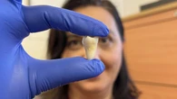 Crean el primer tratamiento para regenerar los dientes humanos que se han caído
