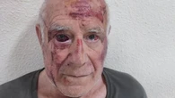 No fue un robo, fue diversión: la escalofriante agresión a un anciano de 70 años en Murcia