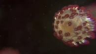El hallazgo que redefine la medicina: así usan bacterias como 'caballos de Troya' para que los virus aniquilen el cáncer desde dentro