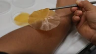 Investigadores españoles crean unas "tiritas" que se activan con la luz solar para reducir el crecimiento bacteriano