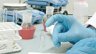 Investigan el potencial de las vacunas de ARNm contra la metástasis del cáncer gástrico