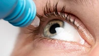 Sanidad ordena la retirada urgente de un colirio muy recetado en España para la conjuntivitis alérgica