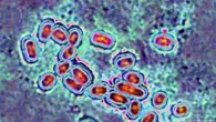 Microrobots combaten infecciones sinusales con precisión quirúrgica