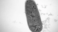 Estos virus podrían salvarnos de la crisis de los antibióticos gracias a un nuevo descubrimiento
