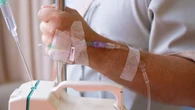 Descubren por qué algunos cánceres de mama son resistentes al tratamiento