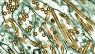 Confirman un nuevo caso de gripe aviar: una menor de 10 años, en Camboya