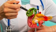 Una nueva esperanza frente al cáncer de páncreas