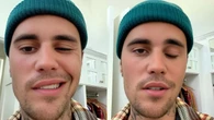 Qué es el síndrome de Ramsay Hunt, la enfermedad que paralizó la cara de Justin Bieber