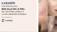 Mesa redonda, en directo: "Más allá de la piel: del síntoma visible a la inflamación invisible"