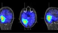 Descubren un mecanismo cerebral que ayuda a superar el miedo