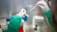Hallan un mecanismo que convierte a células inmunes en enemigas, propiciando el crecimiento tumoral