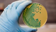 Brote de listeria en Francia: polémica tras la tardanza en retirar los quesos contaminados