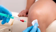 Una operación de rodilla termina en tragedia: indemnizan a la familia con 100.000 euros