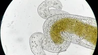 Las olas de calor pueden multiplicar hasta por 13 la carga de enfermedades infecciosas