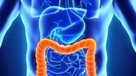 Duplican la supervivencia en cáncer de colon metastásico gracias a una nueva estrategia terapéutica