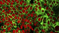 Identifican la célula que activa la respuesta del sistema inmune frente al cáncer