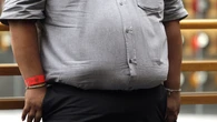 Un macroestudio desmonta la 'epidemia global' de obesidad y sitúa a España como una excepción positiva