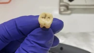 Resuelto uno de los misterios más antiguos: descubren la bacteria que originó la primera pandemia