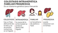 Colestasis intrahepática familiar: cuando el picor resta calidad de vida