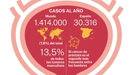 Identifican un tratamiento perioperatorio que mejora el pronóstico del cáncer de próstata de alto riesgo