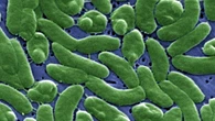 Alerta por aumento inusual de muertes por bacteria "come carne"