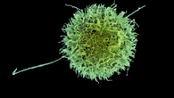 Crean 'super células' asesinas del cáncer que son invisibles al sistema inmunitario